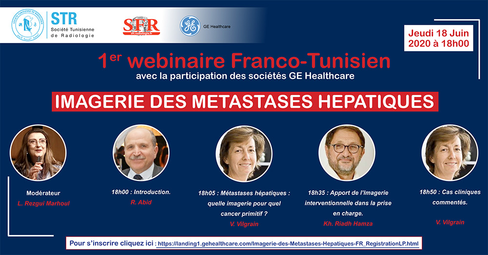 Webinaire Franco Tunisien - 1er HEPATIQUES METASTASES DES IMAGERIE