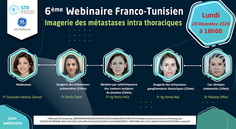 6ème Webinaire Franco-Tunisien