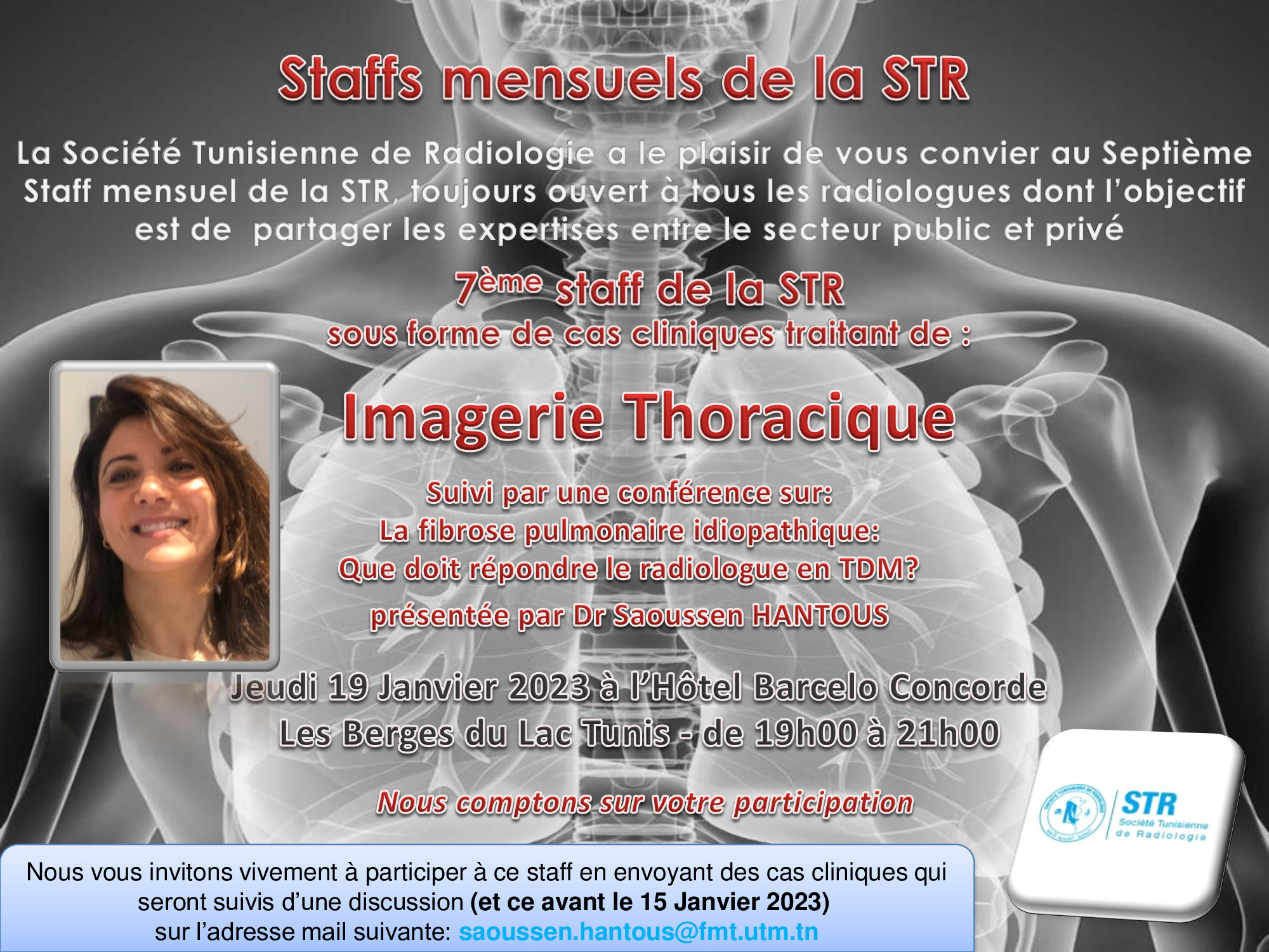 Affiche — 7ème staff de la STR : Imagerie Thoracique