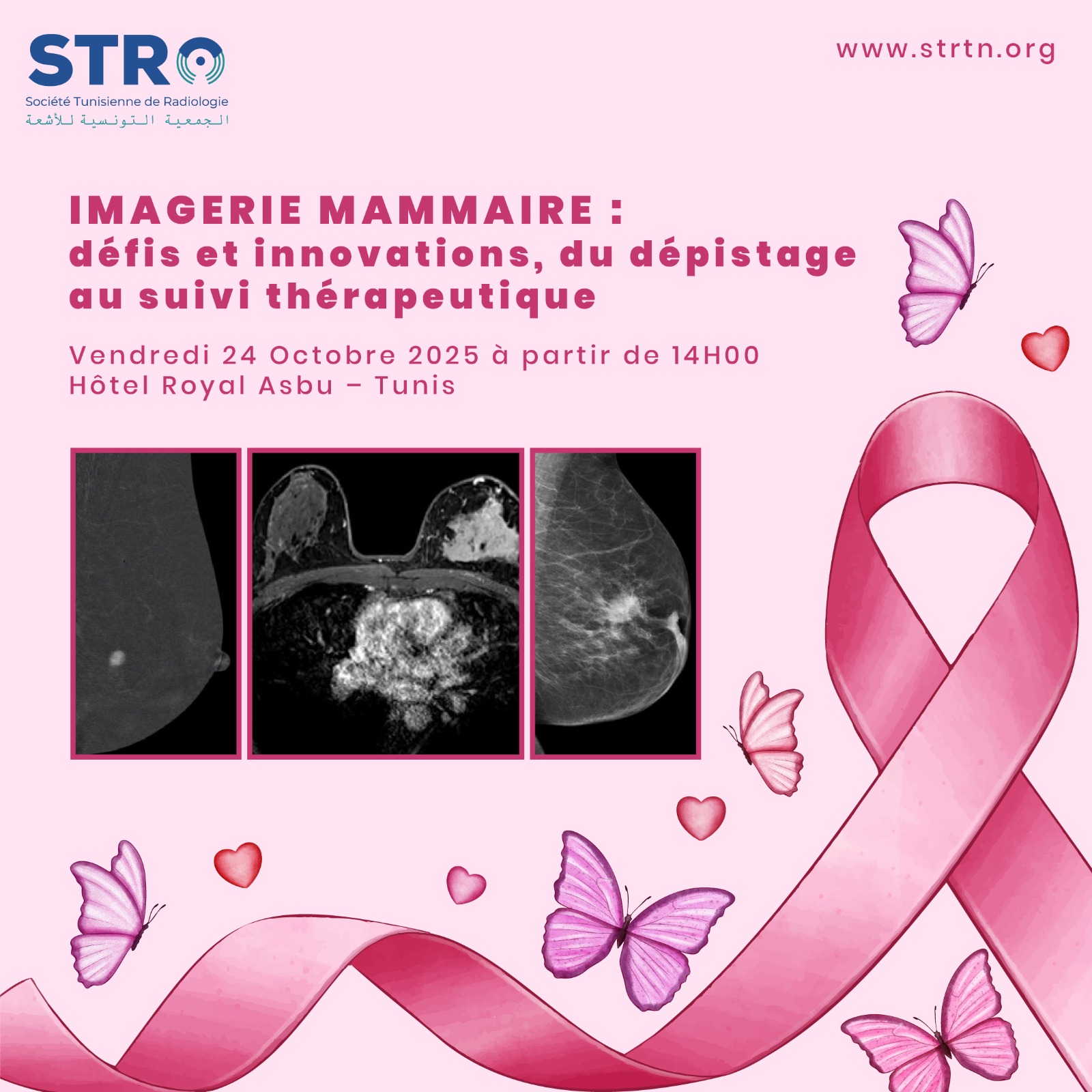 Affiche — Imagerie mammaire : défis et innovations, du dépistage au suivi thérapeutique
