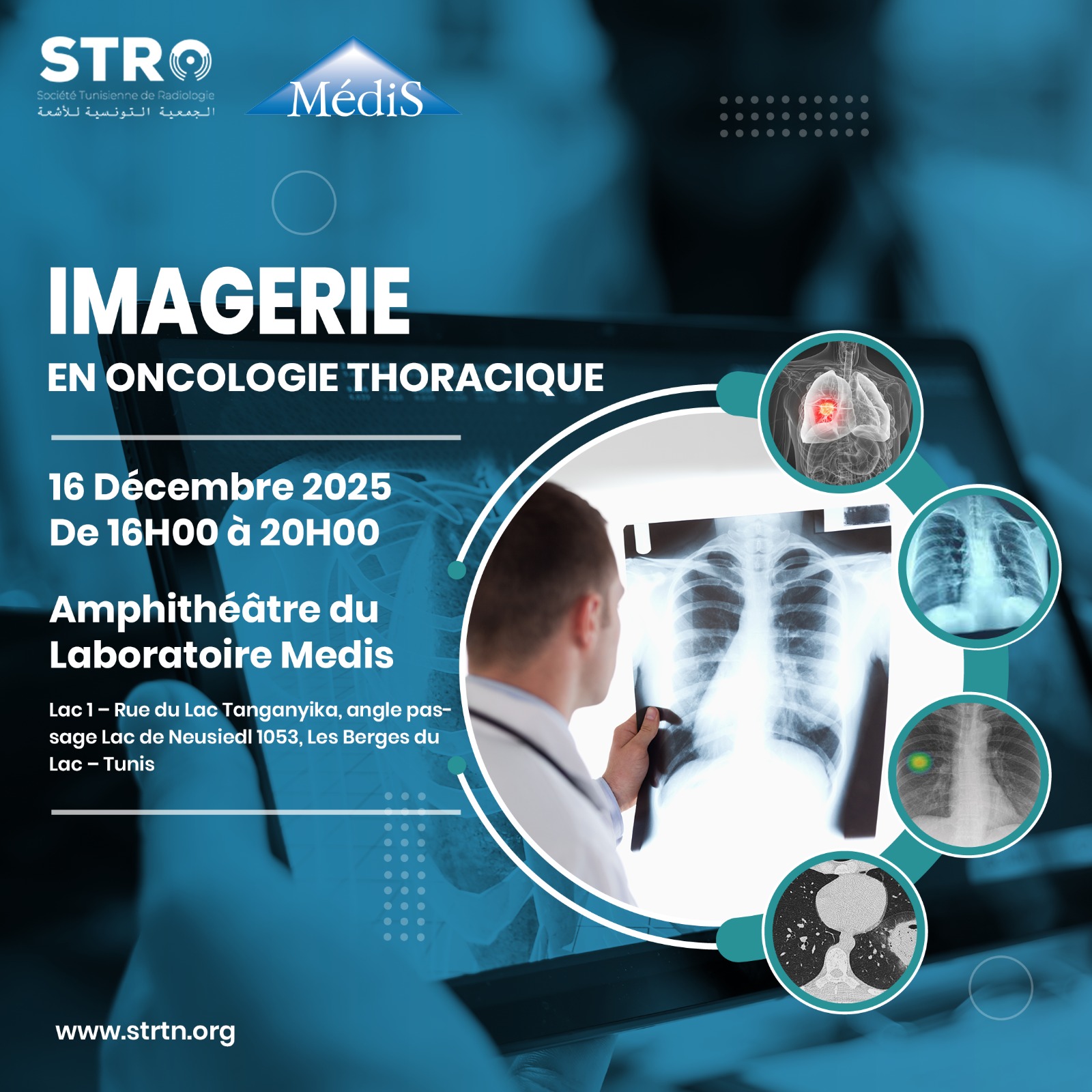 Affiche — Imagerie en oncologie thoracique