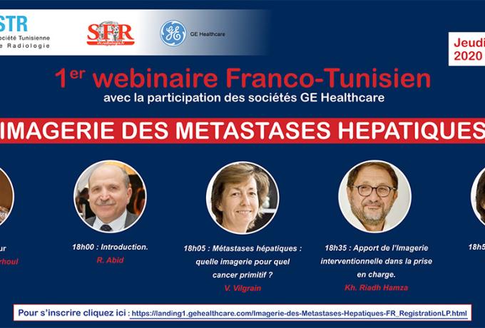 Webinaire Franco Tunisien - 1er HEPATIQUES METASTASES DES IMAGERIE