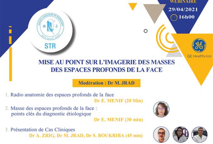 MISE AU POINT SUR L’IMAGERIE DES MASSES DES ESPACES PROFONDS DE LA FACE