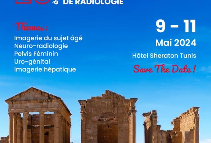 23èmes JOURNÉES FRANCO-TUNISIENNES DE RADIOLOGIE