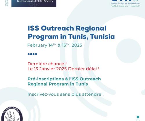 tst